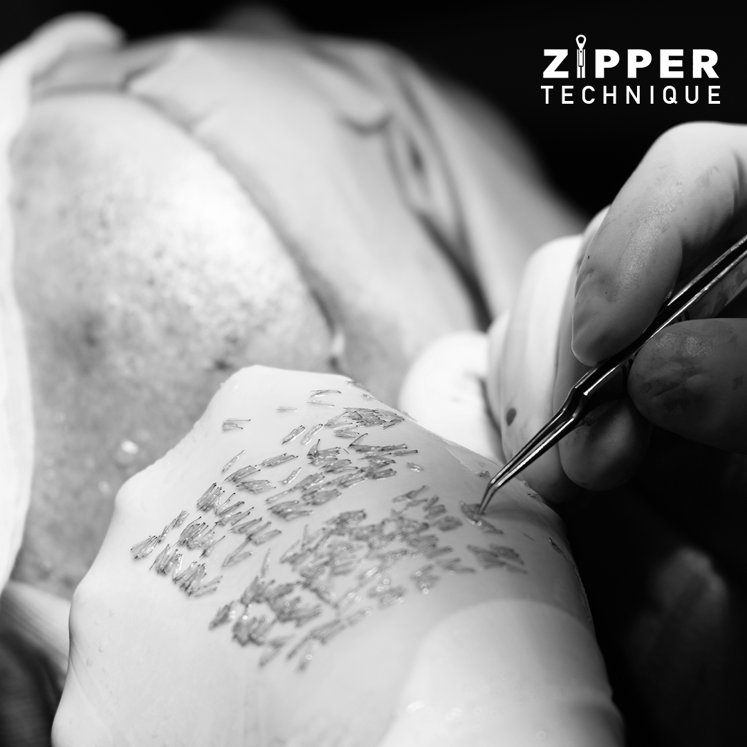 Clinique capillaire  
transplantation et traitement