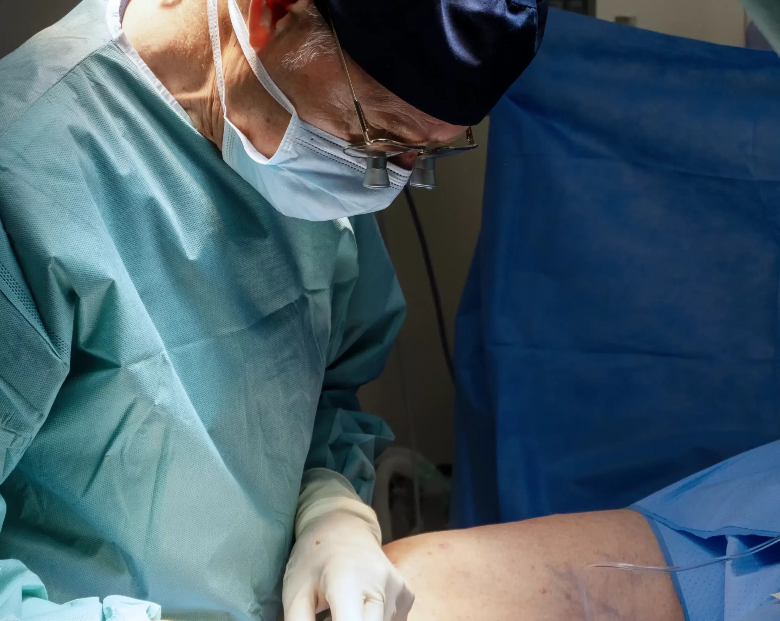 Traitements des Varices : Découvrez la Méthode ASVAL par le Dr Pittaluga